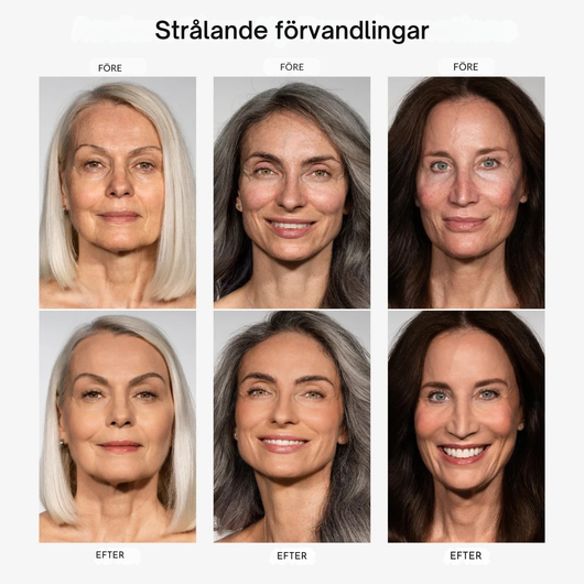 ReLift- Naturligt vackrare hud